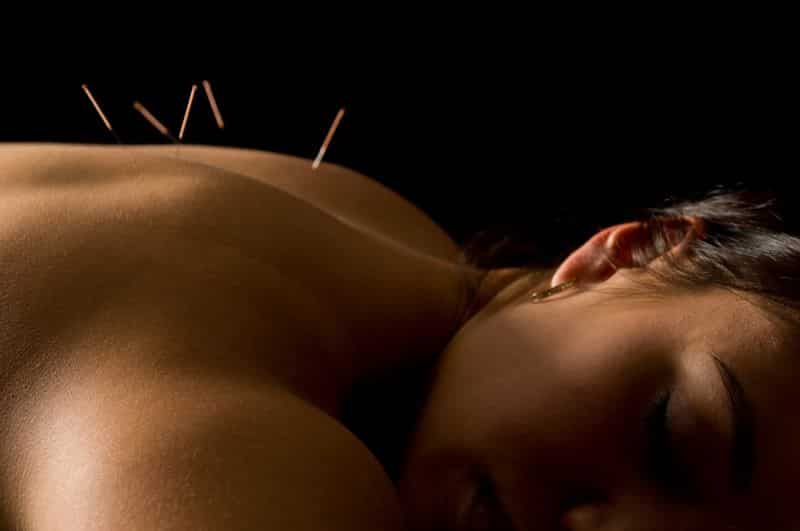 What are 3 Benefits of Acupuncture?